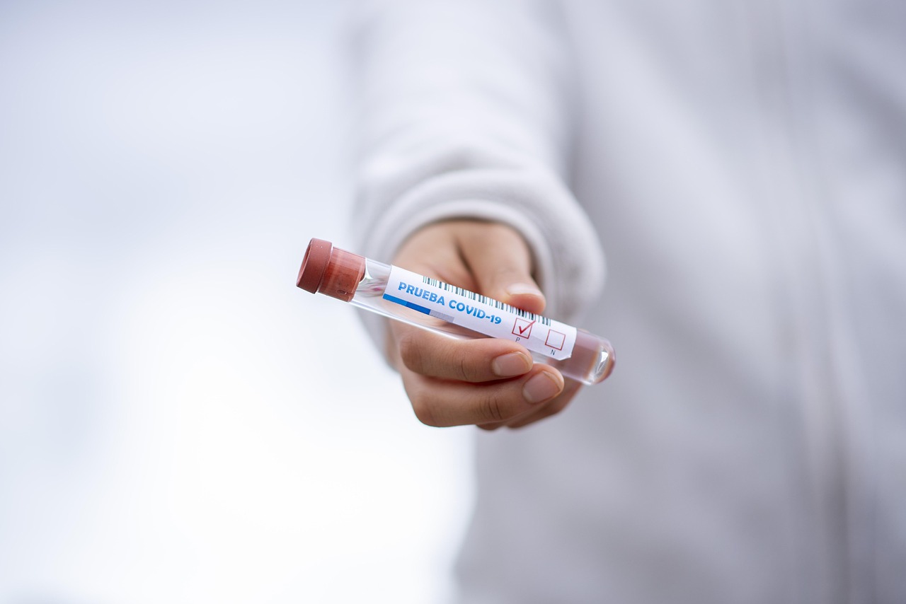 Ręka trzymająca probówkę testową COVID-19, gotową do pobrania próbki.
